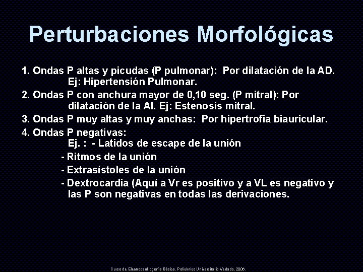 Perturbaciones Morfológicas 1. Ondas P altas y picudas (P pulmonar): Por dilatación de la