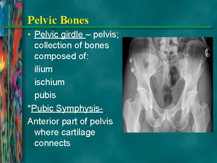 Pelvic Bones • Pelvic girdle – pelvis; collection of bones composed of: ilium ischium
