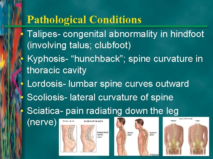 Pathological Conditions • Talipes- congenital abnormality in hindfoot (involving talus; clubfoot) • Kyphosis- “hunchback”;