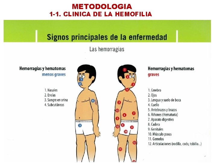 METODOLOGIA 1 -1. CLINICA DE LA HEMOFILIA 
