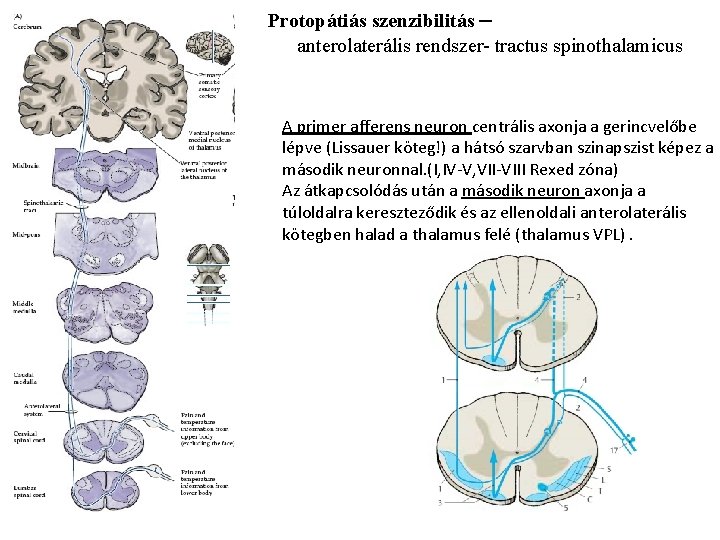 Protopátiás szenzibilitás – anterolaterális rendszer- tractus spinothalamicus A primer afferens neuron centrális axonja a