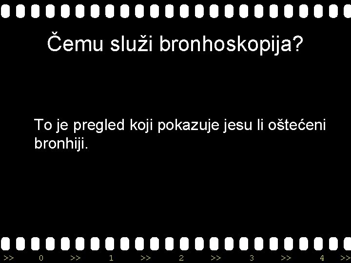 Čemu služi bronhoskopija? To je pregled koji pokazuje jesu li oštećeni bronhiji. >> 0