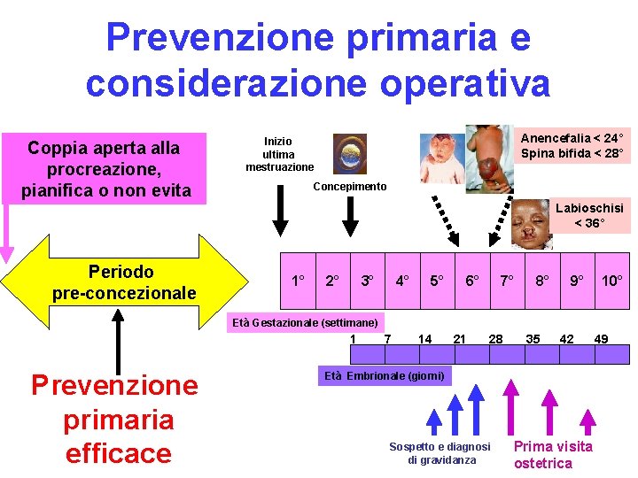 Prevenzione primaria e considerazione operativa Coppia aperta alla procreazione, pianifica o non evita Anencefalia