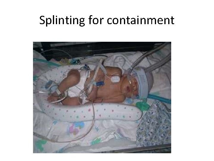 Splinting for containment 