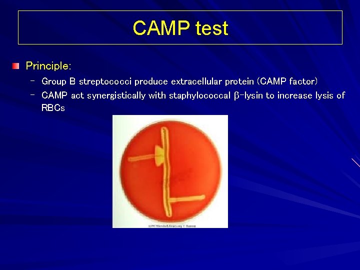 CAMP test Principle: – Group B streptococci produce extracellular protein (CAMP factor) – CAMP