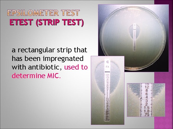 ETEST (STRIP TEST) a rectangular strip that has been impregnated with antibiotic, used to