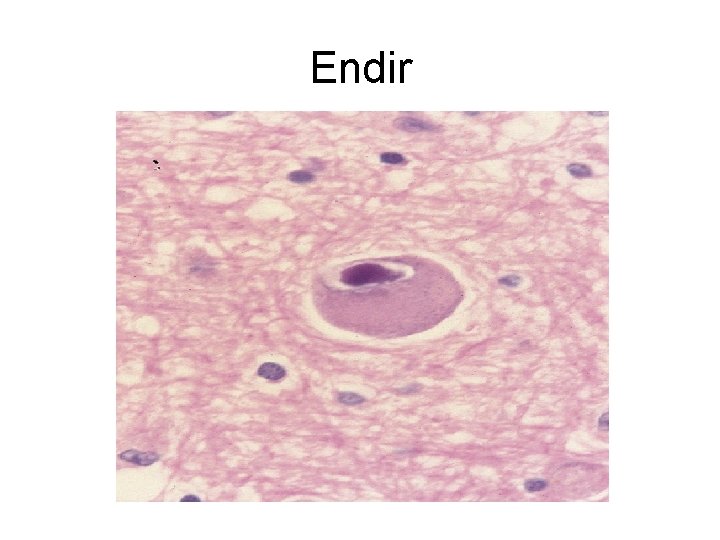 Endir 