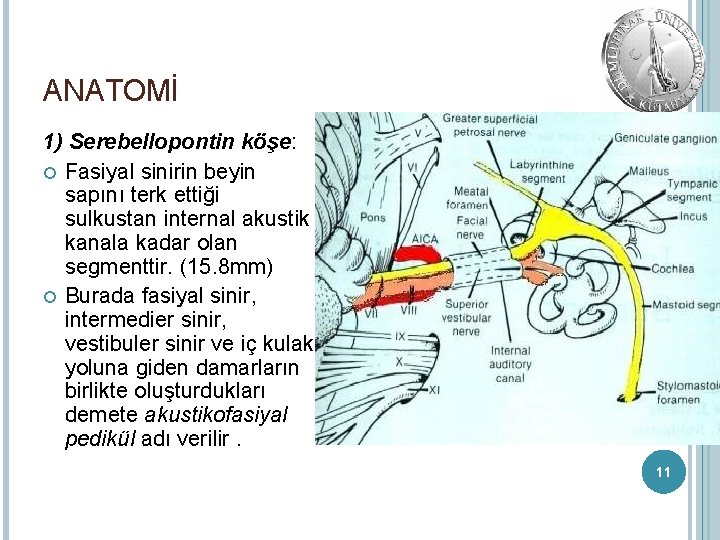 ANATOMİ 1) Serebellopontin köşe: Fasiyal sinirin beyin sapını terk ettiği sulkustan internal akustik kanala