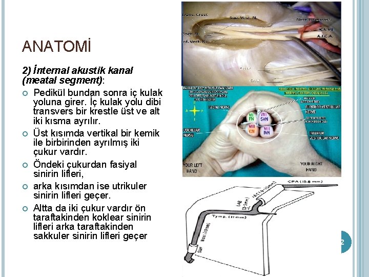 ANATOMİ 2) İnternal akustik kanal (meatal segment): Pedikül bundan sonra iç kulak yoluna girer.
