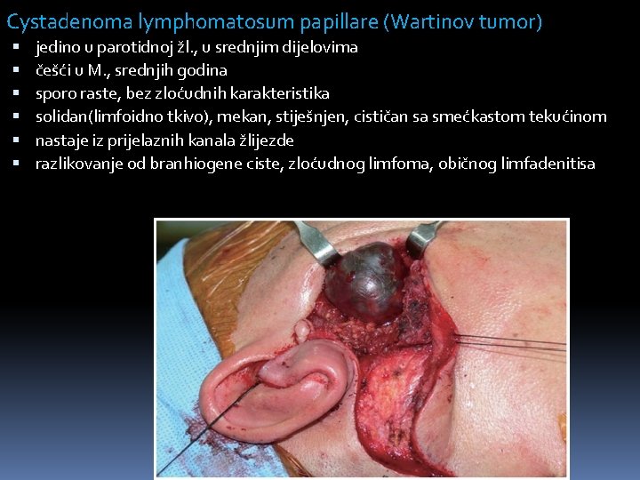 Cystadenoma lymphomatosum papillare (Wartinov tumor) jedino u parotidnoj žl. , u srednjim dijelovima češći