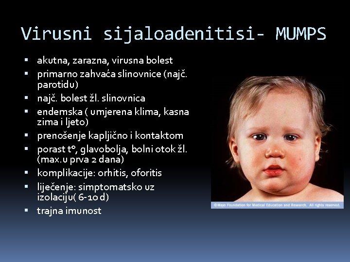 Virusni sijaloadenitisi- MUMPS akutna, zarazna, virusna bolest primarno zahvaća slinovnice (najč. parotidu) najč. bolest