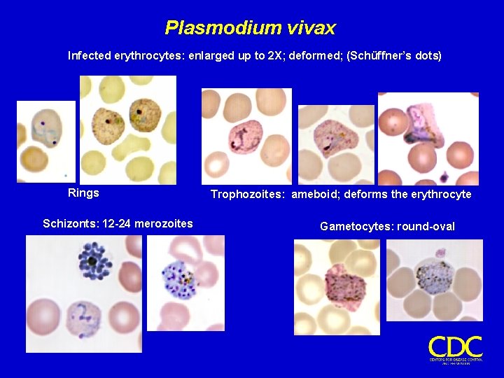 Plasmodium vivax Infected erythrocytes: enlarged up to 2 X; deformed; (Schüffner’s dots) Rings Schizonts: