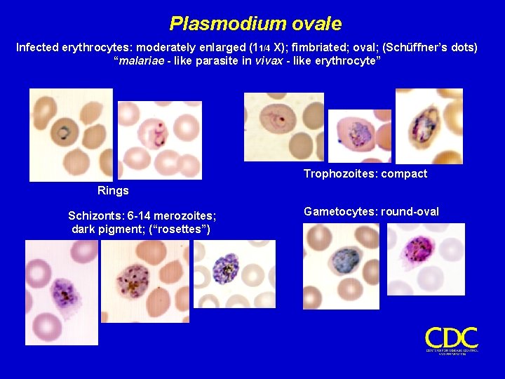 Plasmodium ovale Infected erythrocytes: moderately enlarged (11/4 X); fimbriated; oval; (Schüffner’s dots) “malariae -