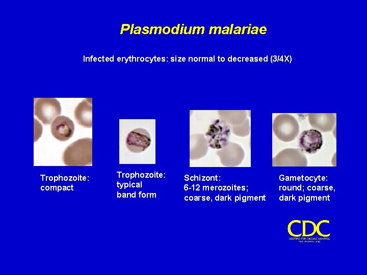 Plasmodium malariae Infected erythrocytes: size normal to decreased (3/4 X) Trophozoite: compact Trophozoite: typical