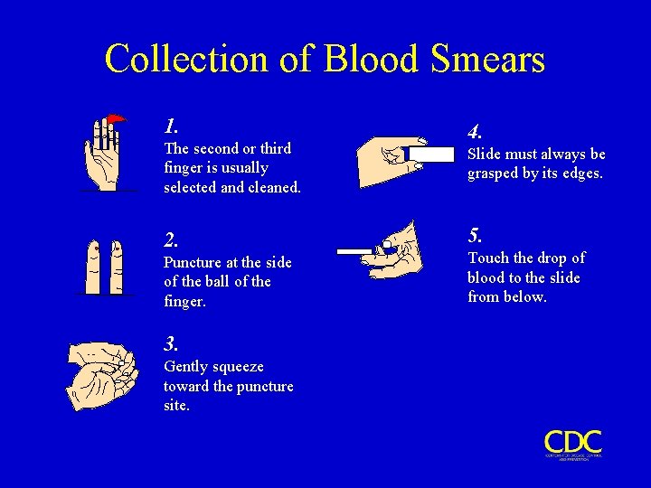 Collection of Blood Smears 1. The second or third finger is usually selected and