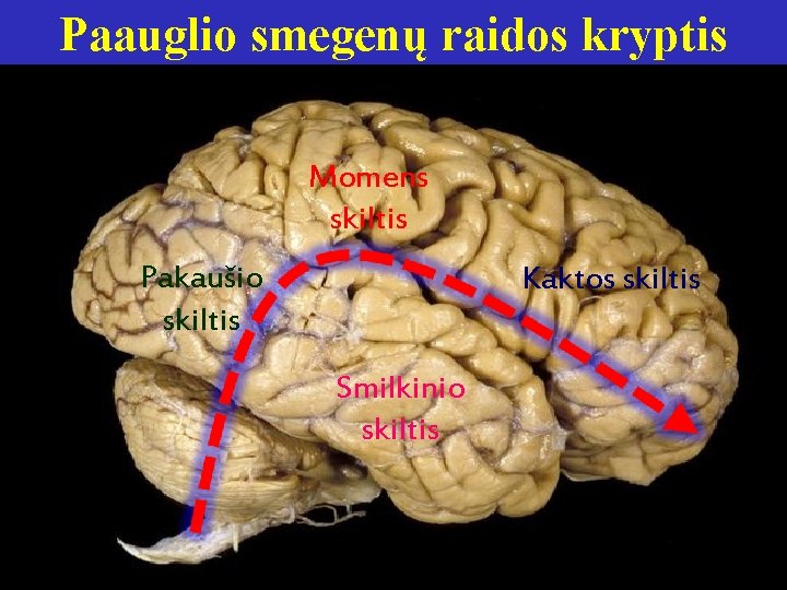 Paauglio smegenų raidos kryptis Momens skiltis Pakaušio skiltis Kaktos skiltis Smilkinio skiltis 