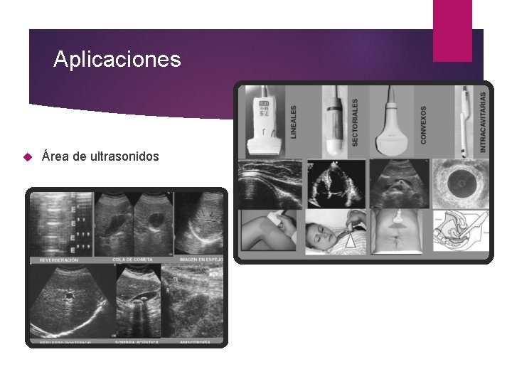 Aplicaciones Área de ultrasonidos 