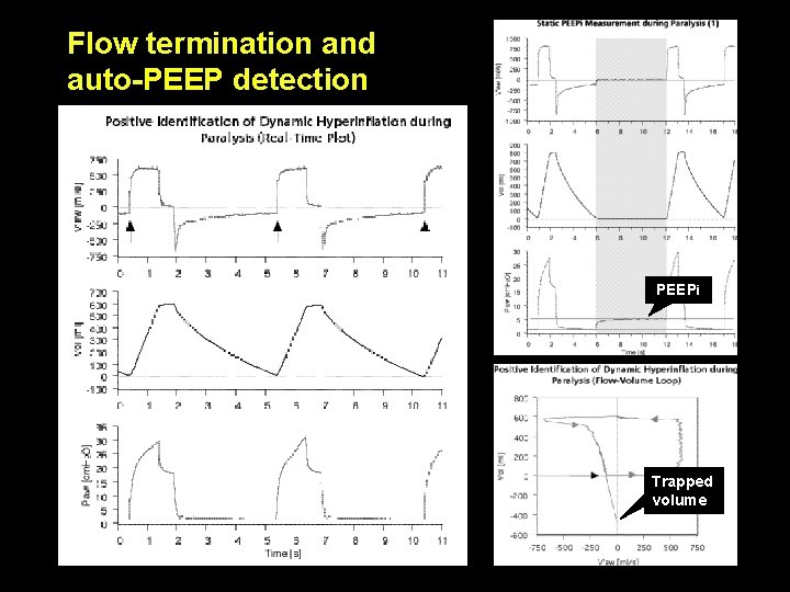 Flow termination and auto-PEEP detection PEEPi Trapped volume Flow termination and auto-PEEP detection PEEPi Trapped volume