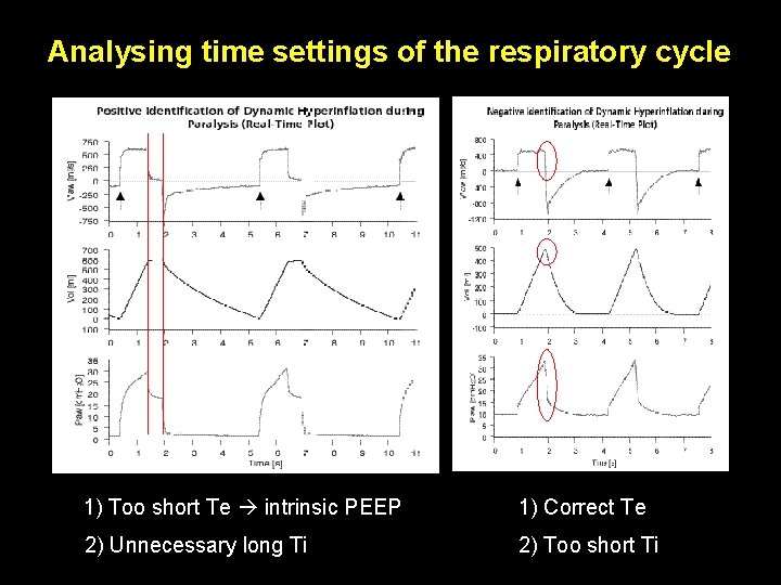 Analysing time settings of the respiratory cycle 1) Too short Te intrinsic PEEP 1) Analysing time settings of the respiratory cycle 1) Too short Te intrinsic PEEP 1)