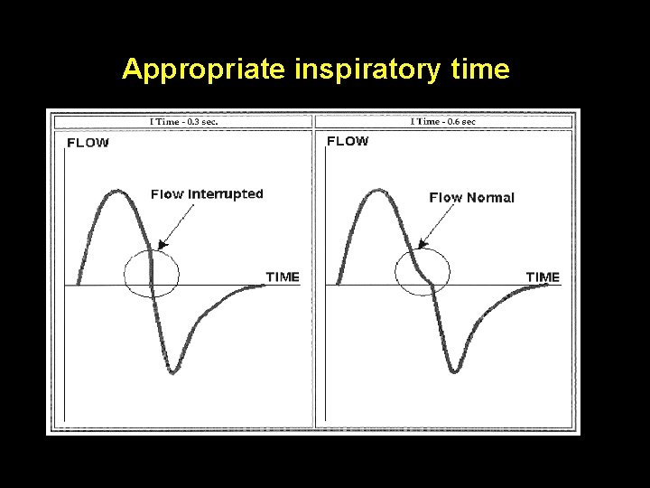 Appropriate inspiratory time Appropriate inspiratory time