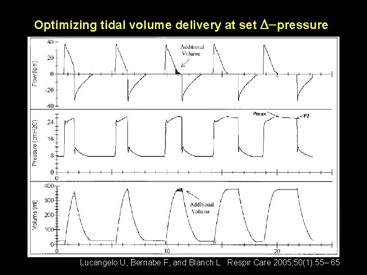Optimizing tidal volume delivery at set D-pressure Lucangelo U, Bernabe F, and Blanch L Optimizing tidal volume delivery at set D-pressure Lucangelo U, Bernabe F, and Blanch L