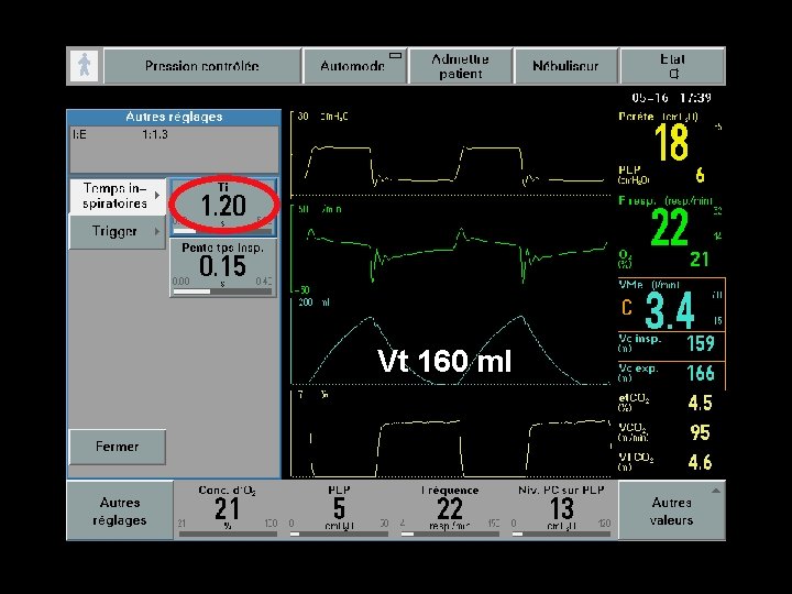 Vt 160 ml Vt 160 ml