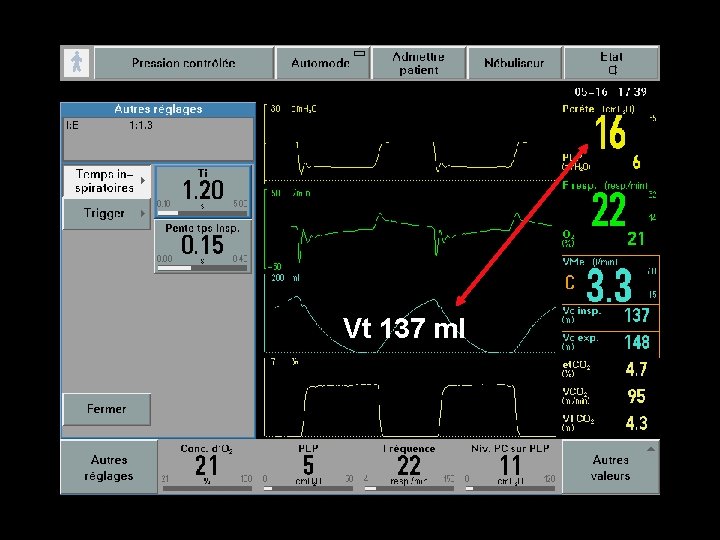 Vt 137 ml Vt 137 ml