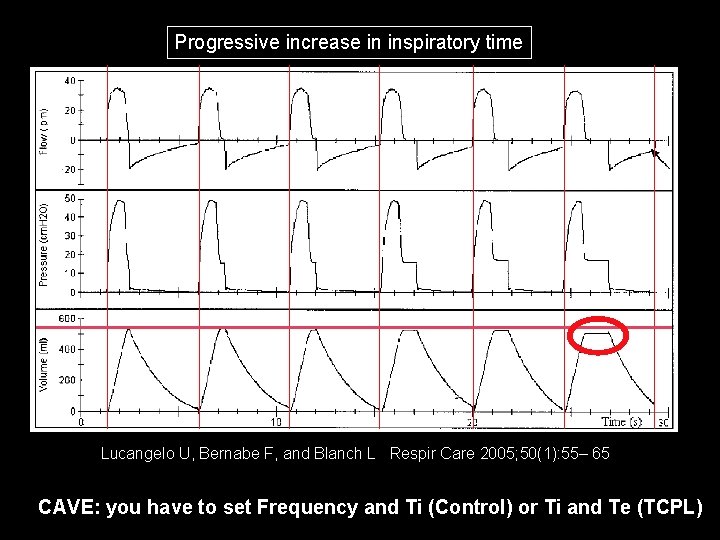 Progressive increase in inspiratory time Lucangelo U, Bernabe F, and Blanch L Respir Care Progressive increase in inspiratory time Lucangelo U, Bernabe F, and Blanch L Respir Care