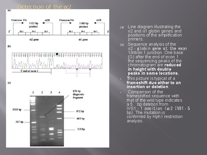 Detection of the α 2 IVS 1– 5 bp del (αHphα/) thalassaemia variant. (a) (b)