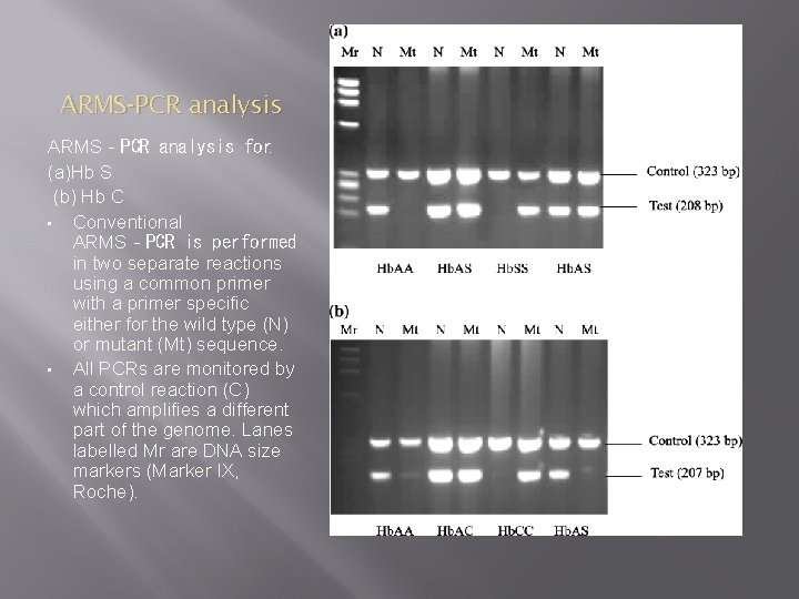 ARMS‐PCR analysis for: (a)Hb S (b) Hb C • Conventional ARMS‐PCR is performed in