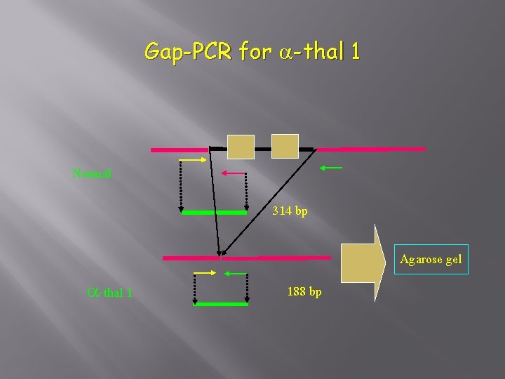 Gap-PCR for a-thal 1 Normal 314 bp Agarose gel a-thal 1 188 bp 