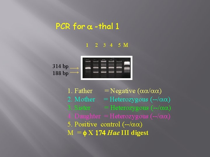 PCR for a -thal 1 1 2 3 4 5 M 314 bp 188