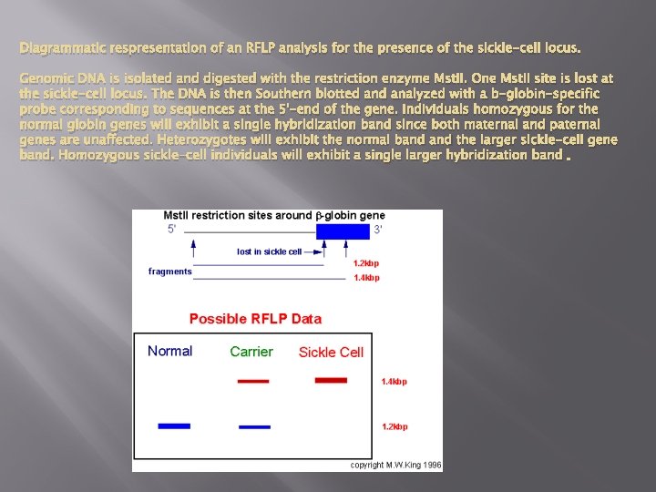 Diagrammatic respresentation of an RFLP analysis for the presence of the sickle-cell locus. Genomic