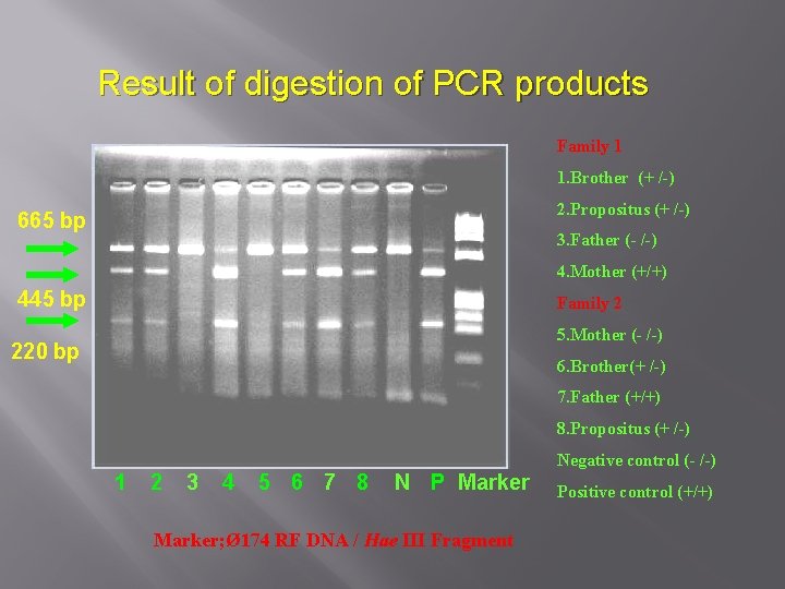 Result of digestion of PCR products Family 1 1. Brother (+ /-) 2. Propositus