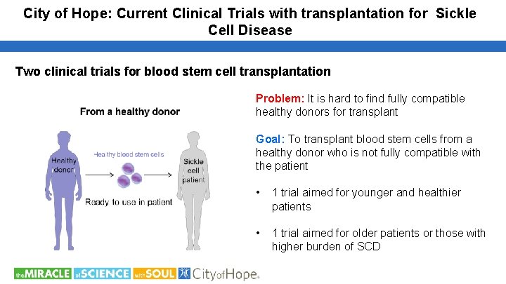 City of Hope: Current Clinical Trials with transplantation for Sickle Cell Disease Two clinical