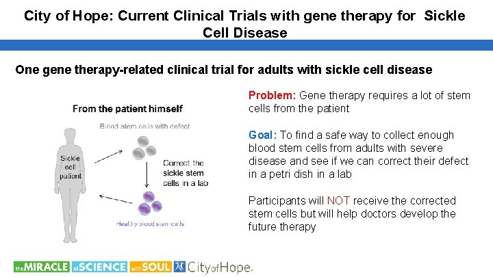 City of Hope: Current Clinical Trials with gene therapy for Sickle Cell Disease One