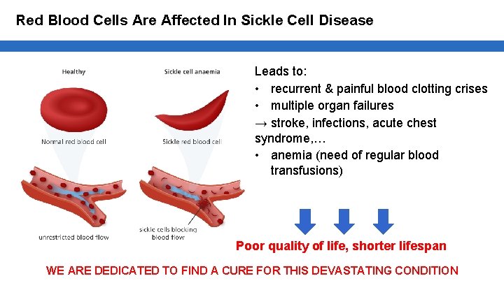 Red Blood Cells Are Affected In Sickle Cell Disease Leads to: • recurrent &