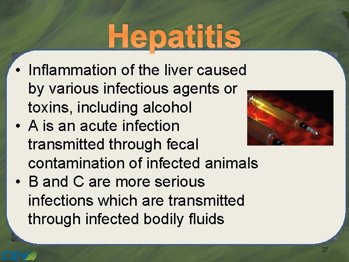 Hepatitis • Inflammation of the liver caused by various infectious agents or toxins, including