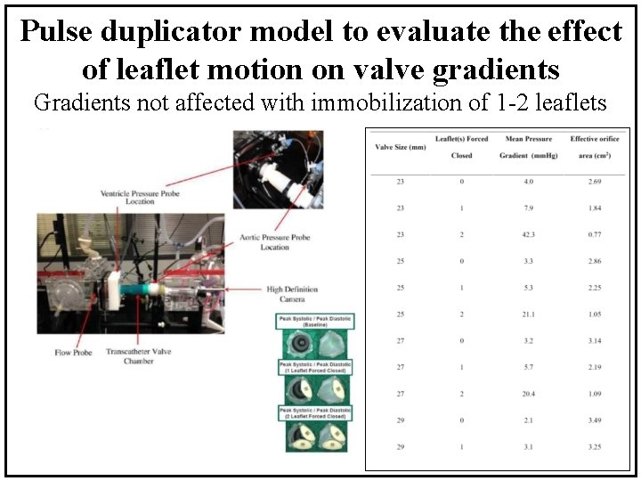 Pulse duplicator model to evaluate the effect of leaflet motion on valve gradients Gradients