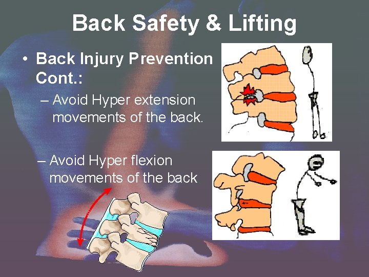 Back Safety & Lifting • Back Injury Prevention Cont. : – Avoid Hyper extension Back Safety & Lifting • Back Injury Prevention Cont. : – Avoid Hyper extension