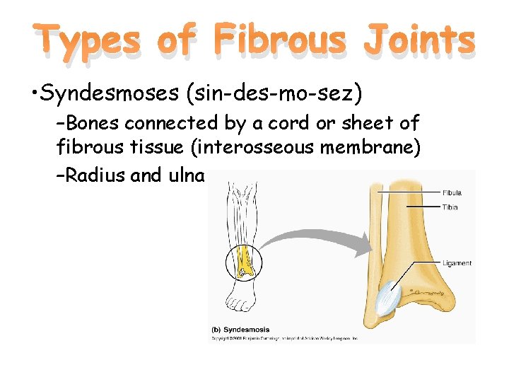 Types of Fibrous Joints • Syndesmoses (sin-des-mo-sez) –Bones connected by a cord or sheet