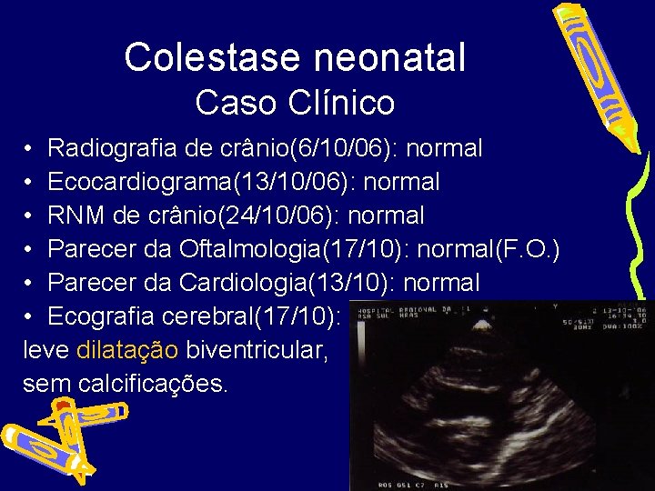 Colestase neonatal Caso Clínico • Radiografia de crânio(6/10/06): normal • Ecocardiograma(13/10/06): normal • RNM