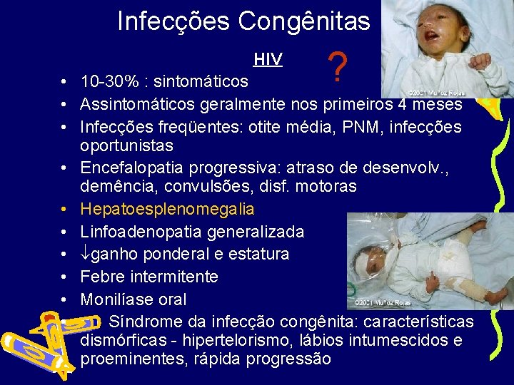 Infecções Congênitas HIV ? • 10 -30% : sintomáticos • Assintomáticos geralmente nos primeiros