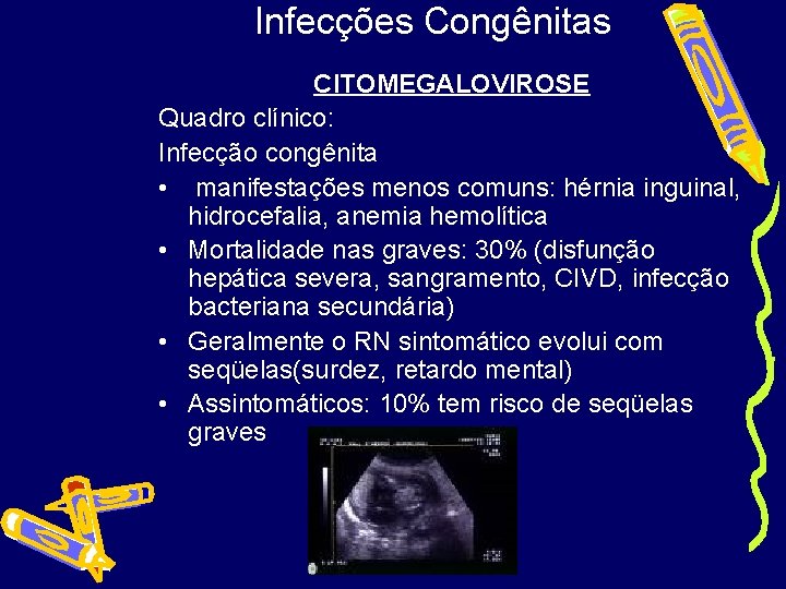 Infecções Congênitas CITOMEGALOVIROSE Quadro clínico: Infecção congênita • manifestações menos comuns: hérnia inguinal, hidrocefalia,