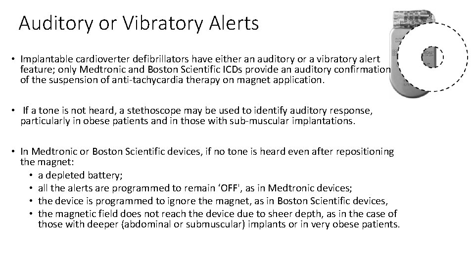 Auditory or Vibratory Alerts • Implantable cardioverter defibrillators have either an auditory or a