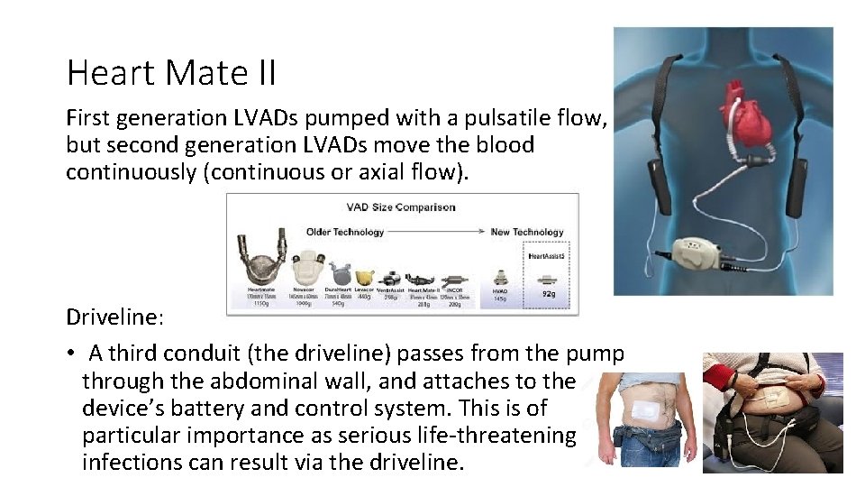 Heart Mate II First generation LVADs pumped with a pulsatile flow, but second generation