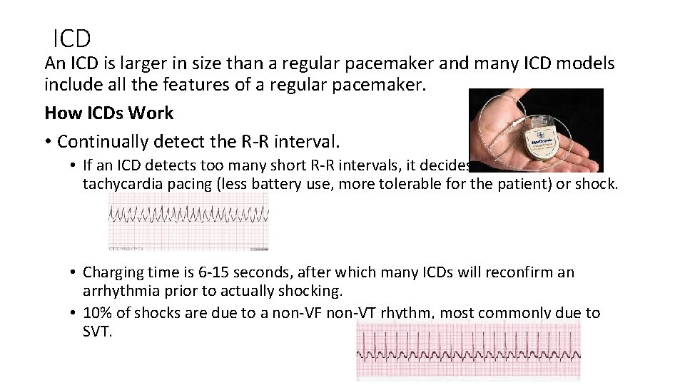 ICD An ICD is larger in size than a regular pacemaker and many ICD