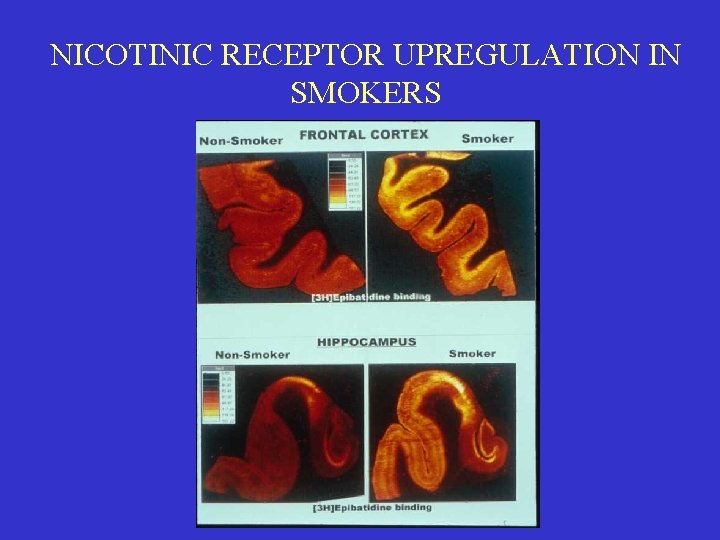 NICOTINIC RECEPTOR UPREGULATION IN SMOKERS 