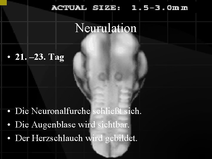 Neurulation • 21. – 23. Tag • Die Neuronalfurche schließt sich. • Die Augenblase