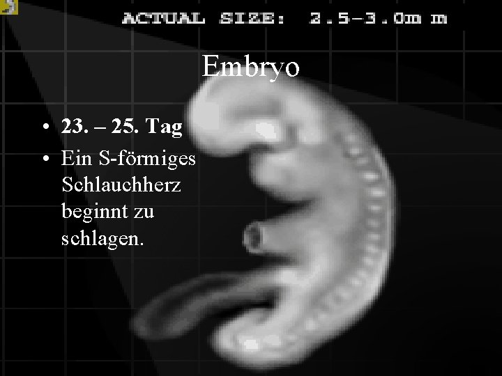 Embryo • 23. – 25. Tag • Ein S-förmiges Schlauchherz beginnt zu schlagen. 